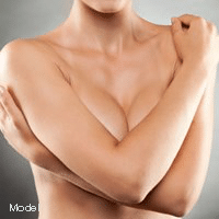 Model image