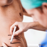 tummy tuck model related porcedures