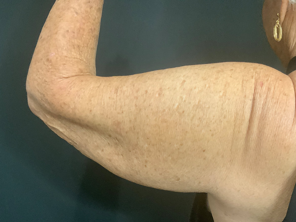 Case--9240 | Before Body