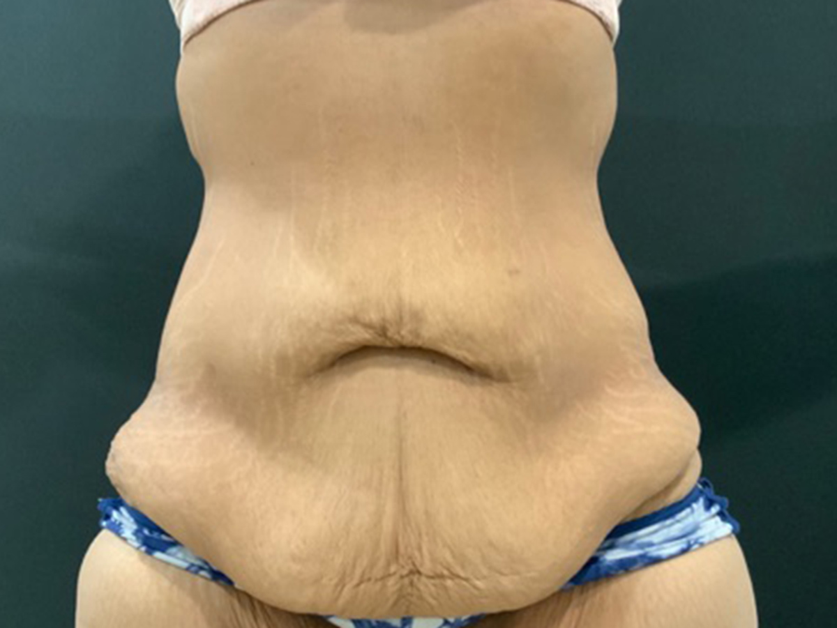 Case--3609 | Before Body