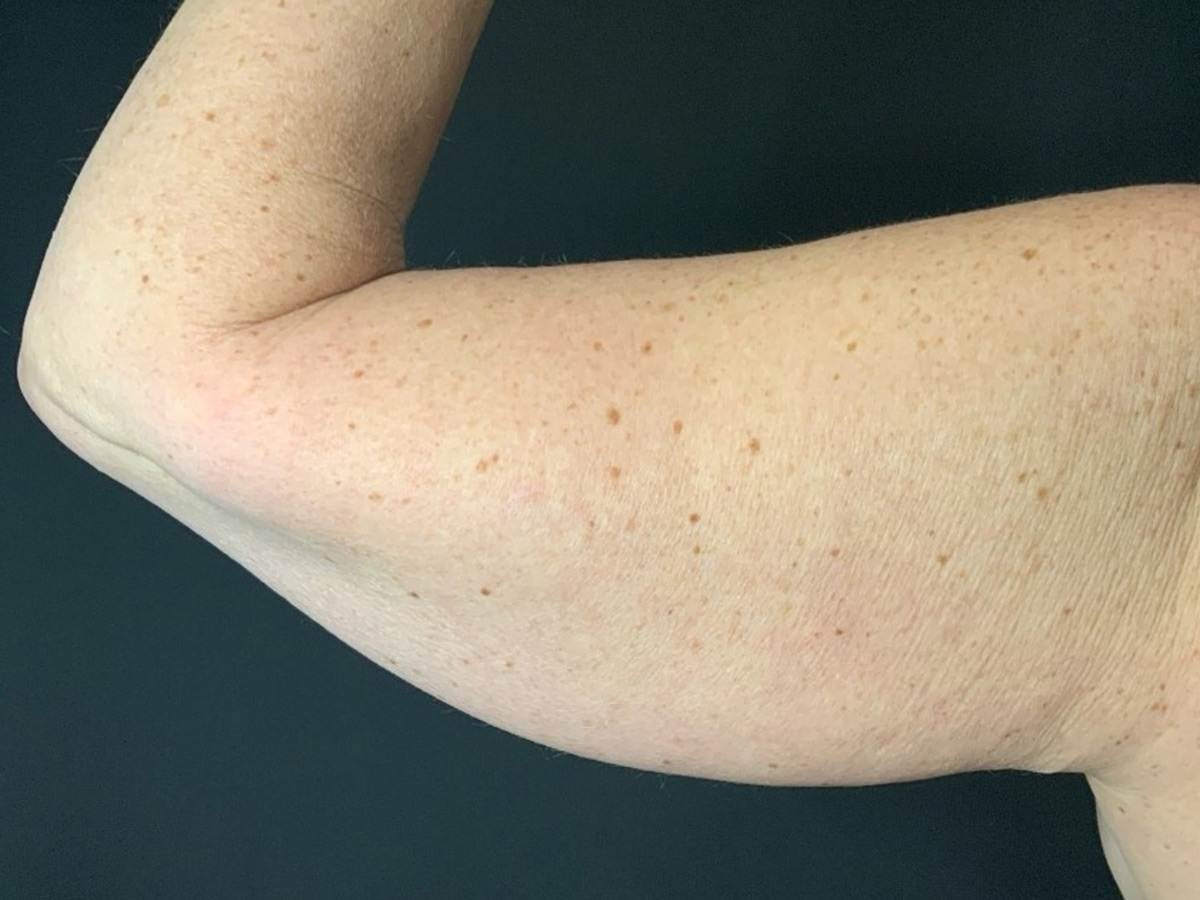 Case--3008 | Before Body